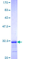 HBG1 / Fetal Hemoglobin Protein - 12.5% SDS-PAGE Stained with Coomassie Blue.