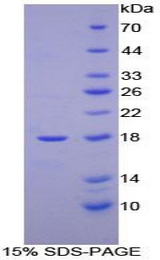 HBM Protein - Recombinant Hemoglobin Mu By SDS-PAGE