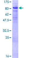 HBP1 Protein - 12.5% SDS-PAGE of human HBP1 stained with Coomassie Blue