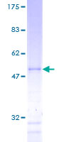 HBP17 / FGFBP1 Protein - 12.5% SDS-PAGE of human FGFBP1 stained with Coomassie Blue