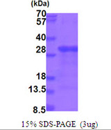 HBP17 / FGFBP1 Protein