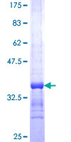 HBQ1 Protein - 12.5% SDS-PAGE Stained with Coomassie Blue.