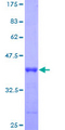 HBXIP Protein - 12.5% SDS-PAGE of human HBXIP stained with Coomassie Blue