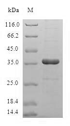 HBXIP Protein - (Tris-Glycine gel) Discontinuous SDS-PAGE (reduced) with 5% enrichment gel and 15% separation gel.