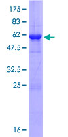 HC71 / GLOD4 Protein - 12.5% SDS-PAGE of human GLOD4 stained with Coomassie Blue