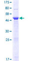 HCA557B / METTL21A Protein - 12.5% SDS-PAGE of human METTL21A stained with Coomassie Blue