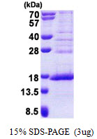 HCA557B / METTL21A Protein