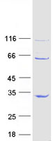 HCA557B / METTL21A Protein - Purified recombinant protein METTL21A was analyzed by SDS-PAGE gel and Coomassie Blue Staining