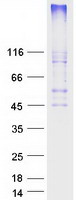 HCAR2 / NIACR1 Protein - Purified recombinant protein HCAR2 was analyzed by SDS-PAGE gel and Coomassie Blue Staining