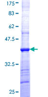 HCCS Protein - 12.5% SDS-PAGE Stained with Coomassie Blue.