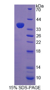 HCCS Protein - Recombinant Holocytochrome C Synthase By SDS-PAGE