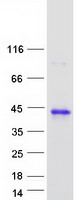 HCCS Protein - Purified recombinant protein HCCS was analyzed by SDS-PAGE gel and Coomassie Blue Staining