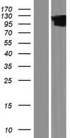 HCCS1 / VPS53 Protein - Western validation with an anti-DDK antibody * L: Control HEK293 lysate R: Over-expression lysate
