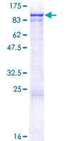 HCCS1 / VPS53 Protein - 12.5% SDS-PAGE of human VPS53 stained with Coomassie Blue