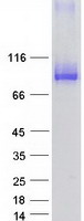 HCCS1 / VPS53 Protein - Purified recombinant protein VPS53 was analyzed by SDS-PAGE gel and Coomassie Blue Staining