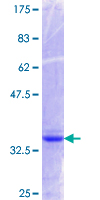 HCF1 / HCFC1 Protein - 12.5% SDS-PAGE Stained with Coomassie Blue.