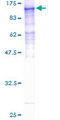 HCFC2 Protein - 12.5% SDS-PAGE of human HCFC2 stained with Coomassie Blue