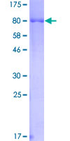 HCK Protein - 12.5% SDS-PAGE of human HCK stained with Coomassie Blue