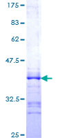 HCK Protein - 12.5% SDS-PAGE Stained with Coomassie Blue.