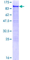 HCLS1 Protein - 12.5% SDS-PAGE of human HCLS1 stained with Coomassie Blue