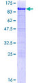 HCLS1 Protein - 12.5% SDS-PAGE of human HCLS1 stained with Coomassie Blue