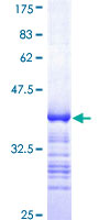 HCLS1 Protein - 12.5% SDS-PAGE Stained with Coomassie Blue.