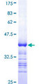 HCLS1 Protein - 12.5% SDS-PAGE Stained with Coomassie Blue.