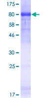 HDAC1 Protein - 12.5% SDS-PAGE of human HDAC1 stained with Coomassie Blue