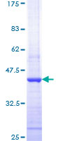 HDAC1 Protein - 12.5% SDS-PAGE Stained with Coomassie Blue.
