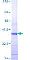 HDAC1 Protein - 12.5% SDS-PAGE Stained with Coomassie Blue.