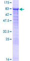 HDAC10 Protein - 12.5% SDS-PAGE of human HDAC10 stained with Coomassie Blue