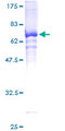 HDAC11 Protein - 12.5% SDS-PAGE of human HDAC11 stained with Coomassie Blue