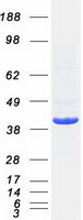 HDAC11 Protein - Purified recombinant protein HDAC11 was analyzed by SDS-PAGE gel and Coomassie Blue Staining
