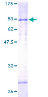 HDAC3 Protein - 12.5% SDS-PAGE of human HDAC3 stained with Coomassie Blue