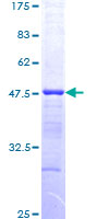 HDAC3 Protein - 12.5% SDS-PAGE Stained with Coomassie Blue.