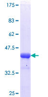 HDAC4 Protein - 12.5% SDS-PAGE Stained with Coomassie Blue.