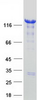 HDAC4 Protein - Purified recombinant protein HDAC4 was analyzed by SDS-PAGE gel and Coomassie Blue Staining