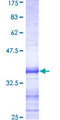 HDAC5 Protein - 12.5% SDS-PAGE Stained with Coomassie Blue.