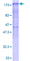 HDAC6 Protein - 12.5% SDS-PAGE of human HDAC6 stained with Coomassie Blue