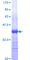 HDAC6 Protein - 12.5% SDS-PAGE Stained with Coomassie Blue.