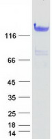 HDAC6 Protein - Purified recombinant protein HDAC6 was analyzed by SDS-PAGE gel and Coomassie Blue Staining