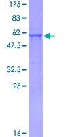 HDAC7 Protein - 12.5% SDS-PAGE of human HDAC7A stained with Coomassie Blue