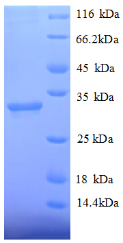 HDAC7 Protein