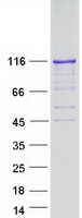 HDAC7 Protein - Purified recombinant protein HDAC7 was analyzed by SDS-PAGE gel and Coomassie Blue Staining