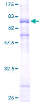 HDAC8 Protein - 12.5% SDS-PAGE of human HDAC8 stained with Coomassie Blue