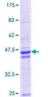 HDAC8 Protein - 12.5% SDS-PAGE Stained with Coomassie Blue.