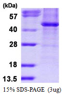 HDAC8 Protein