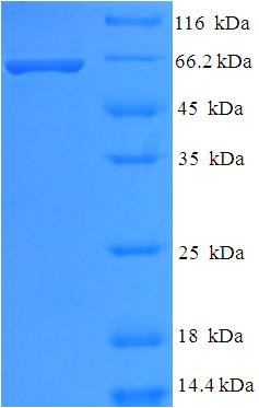 HDAC8 Protein
