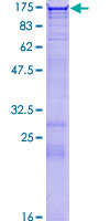 HDAC9 Protein - 12.5% SDS-PAGE of human HDAC9 stained with Coomassie Blue
