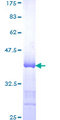 HDAC9 Protein - 12.5% SDS-PAGE Stained with Coomassie Blue.